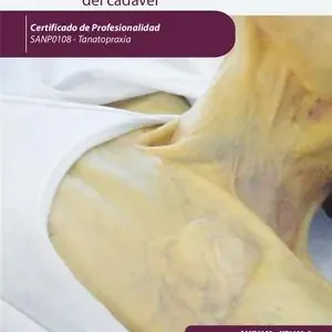 EXTRACCIONES DE TEJIDOS, PRÓTESIS, MARCAPASOS Y OTROS DISPOSITIVOS CONTAMINANTES Top-Angebot