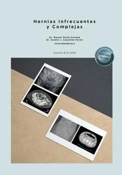 HERNIAS INFRECUENTES Y COMPLEJAS Markenware